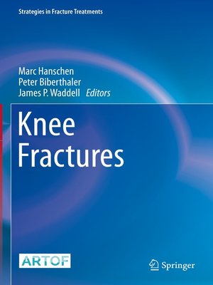cover image of Knee Fractures